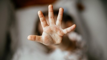 Pemkot Yogyakarta Bergerak Cepat: Bentuk Tim Khusus Dukungan Psikologis Korban Dugaan Kekerasan di Daycare Little Aresha