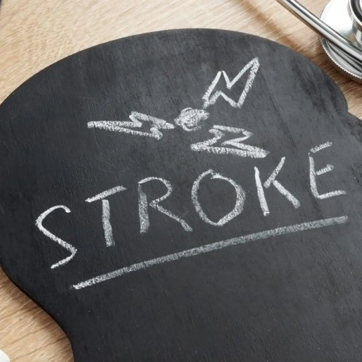 Kejutan Medis: Mahasiswi 22 Tahun Terserang Stroke Akibat Kombinasi Kelainan Jantung dan Kontrasepsi